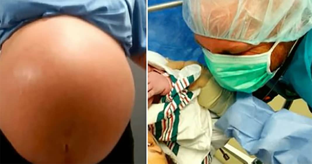 Mom hears staff shouting during C-section, before doctors handed her biggest baby they’d ever seen