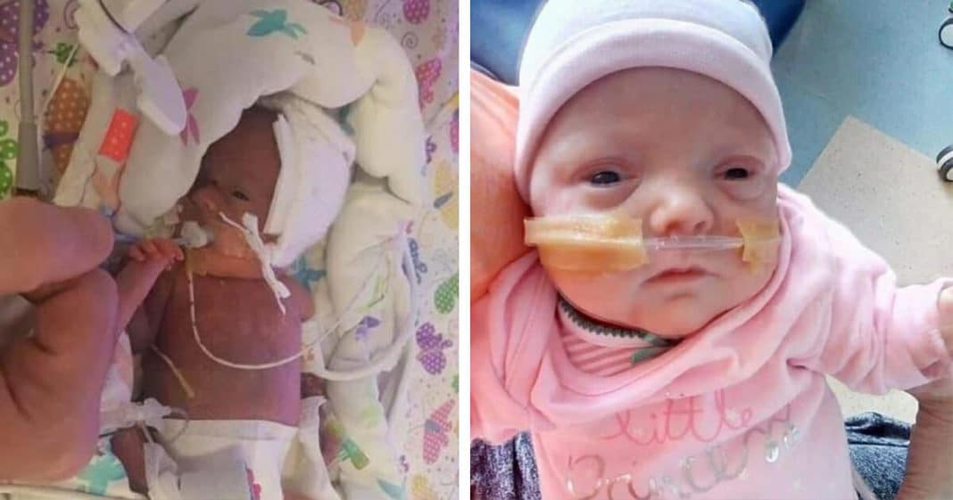 Baby Girl Born The Size Of A Chocolate Bar Finally Sent Home Just In Time For Christmas
