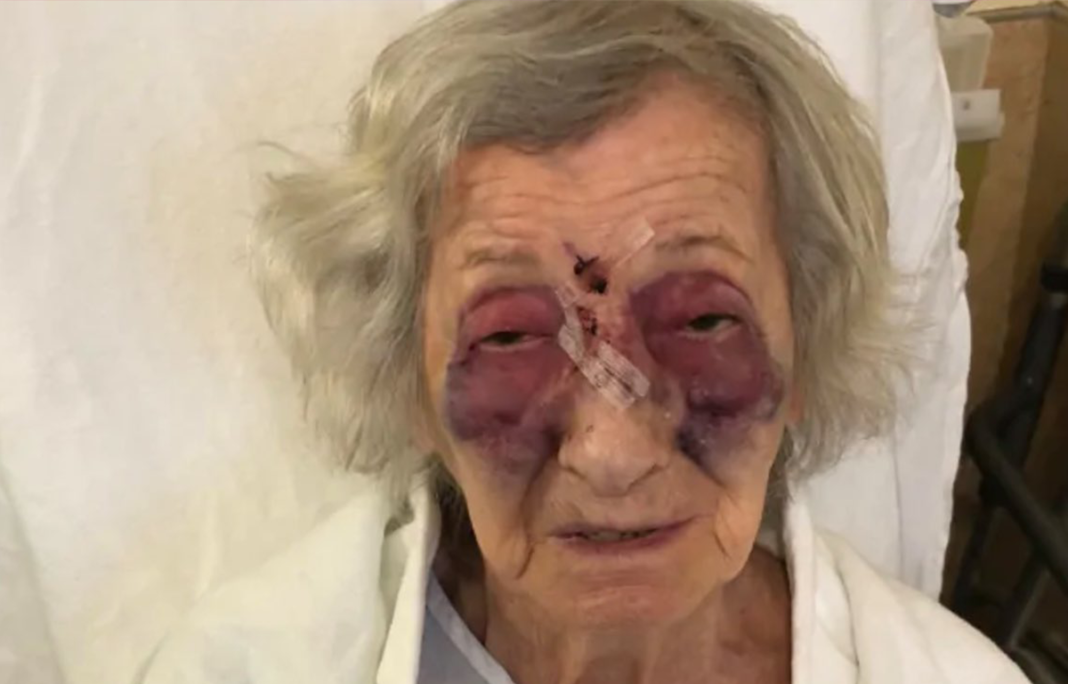 92-year-old holocaust survivor beaten black and blue while using public taxi service for elderly and disabled