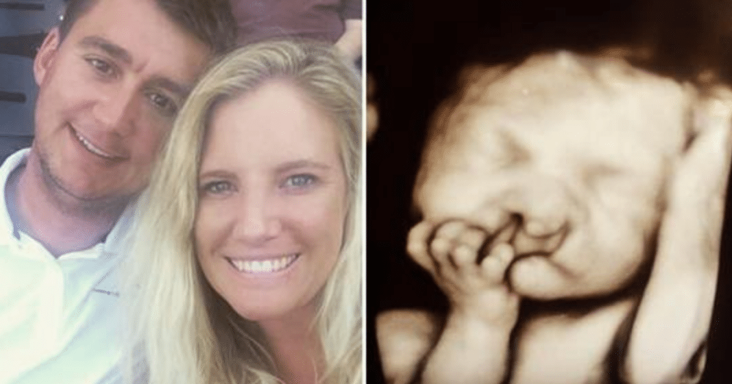 Mom gives birth to ‘deformed’ baby – 2 years later, just look at him now