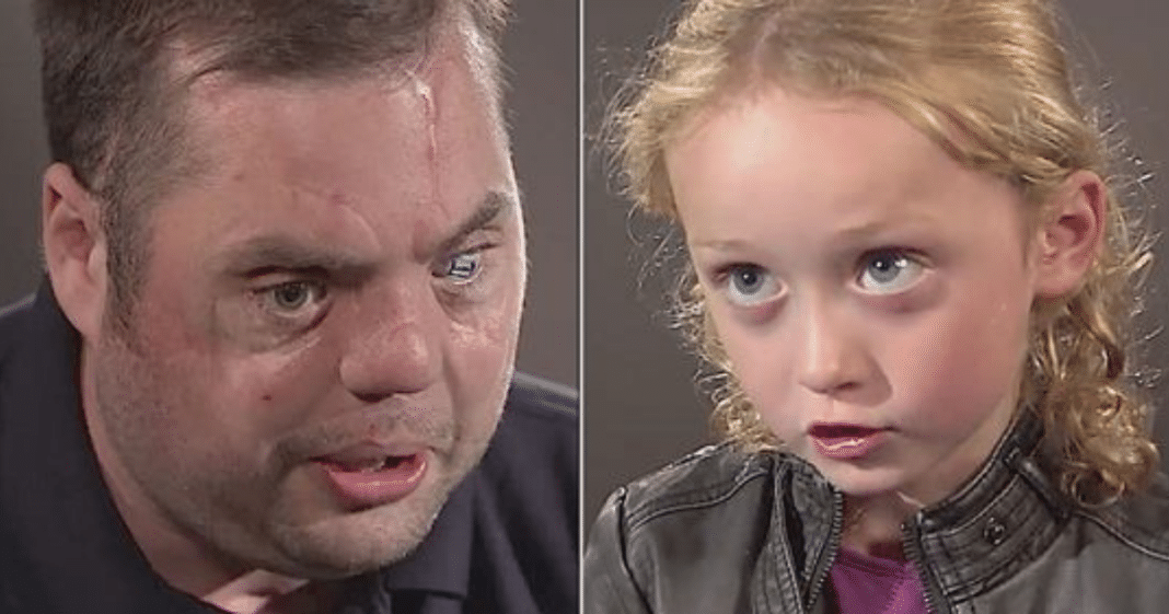 Disfigured vet comes face-to-face with a 5-year-old girl. See her reaction to him and his scars