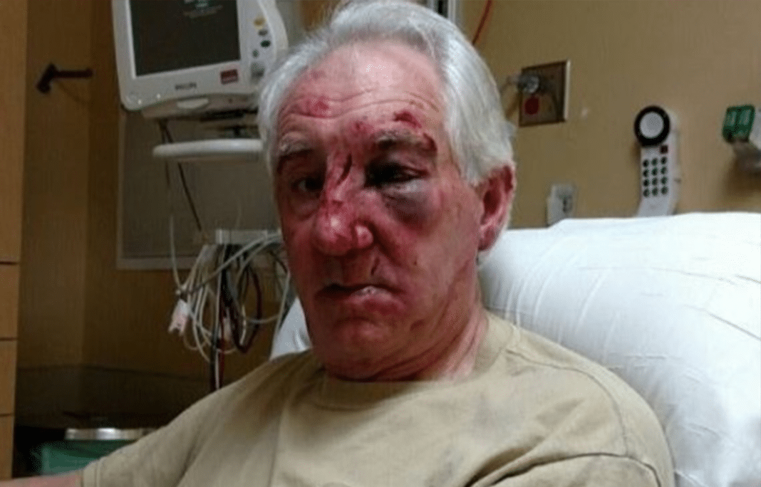 71-year-old beaten after road rage incident, family asking for help finding monster responsible