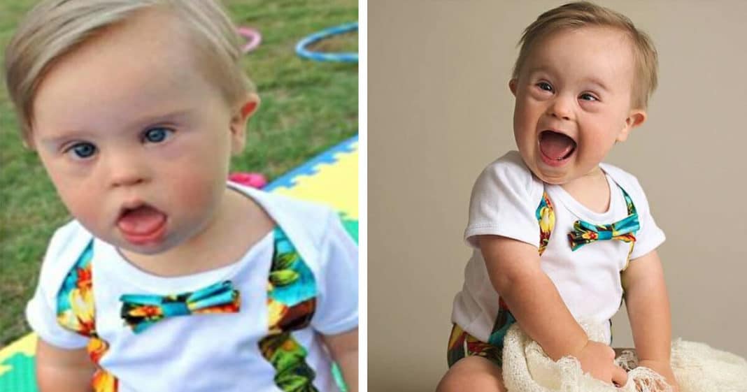 Baby rejected by modeling agency for having Down syndrome becomes popular, lands major ad campaign