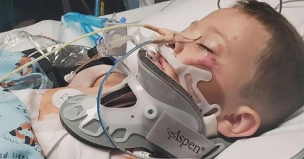 5-year-old fighting for his life after being crushed by vehicle backing out of driveway